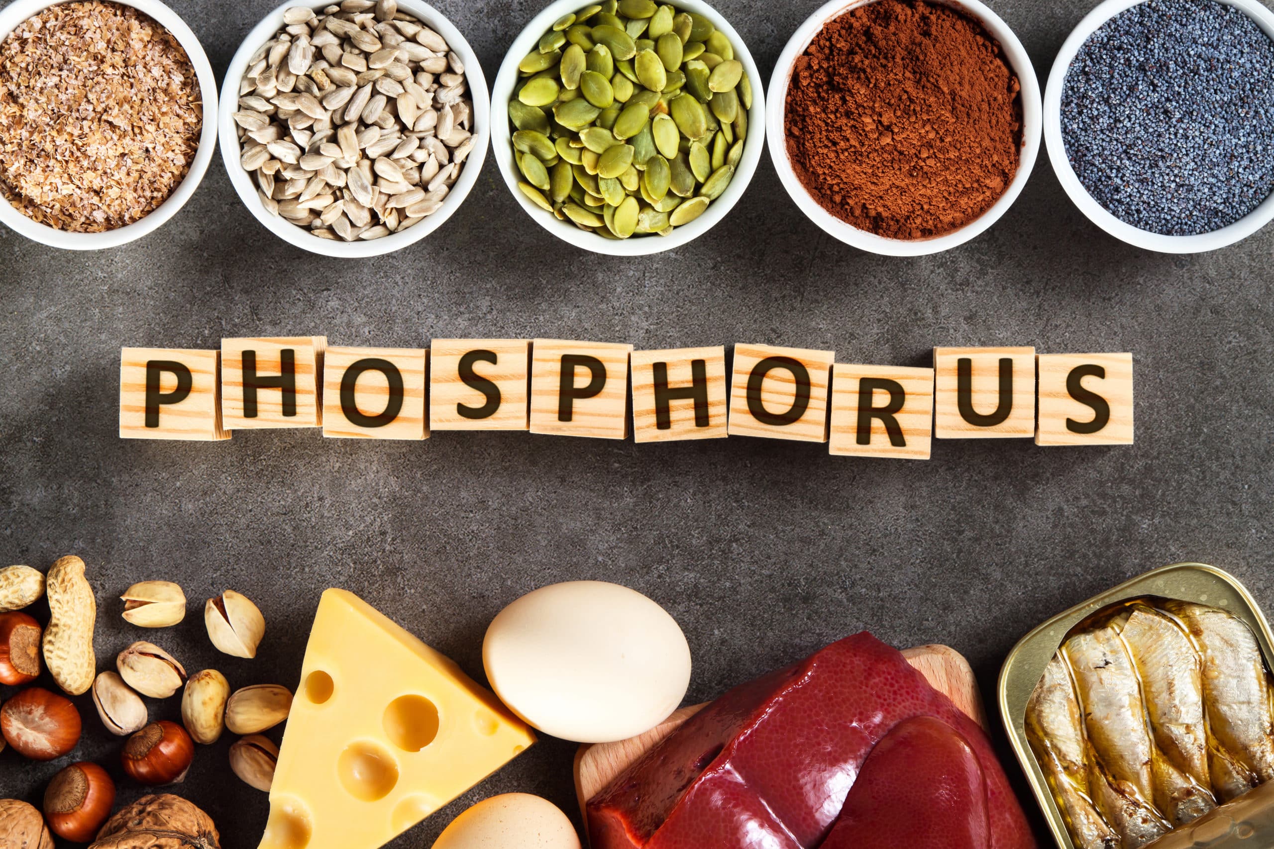Phosphorémie et prise en charge diététique