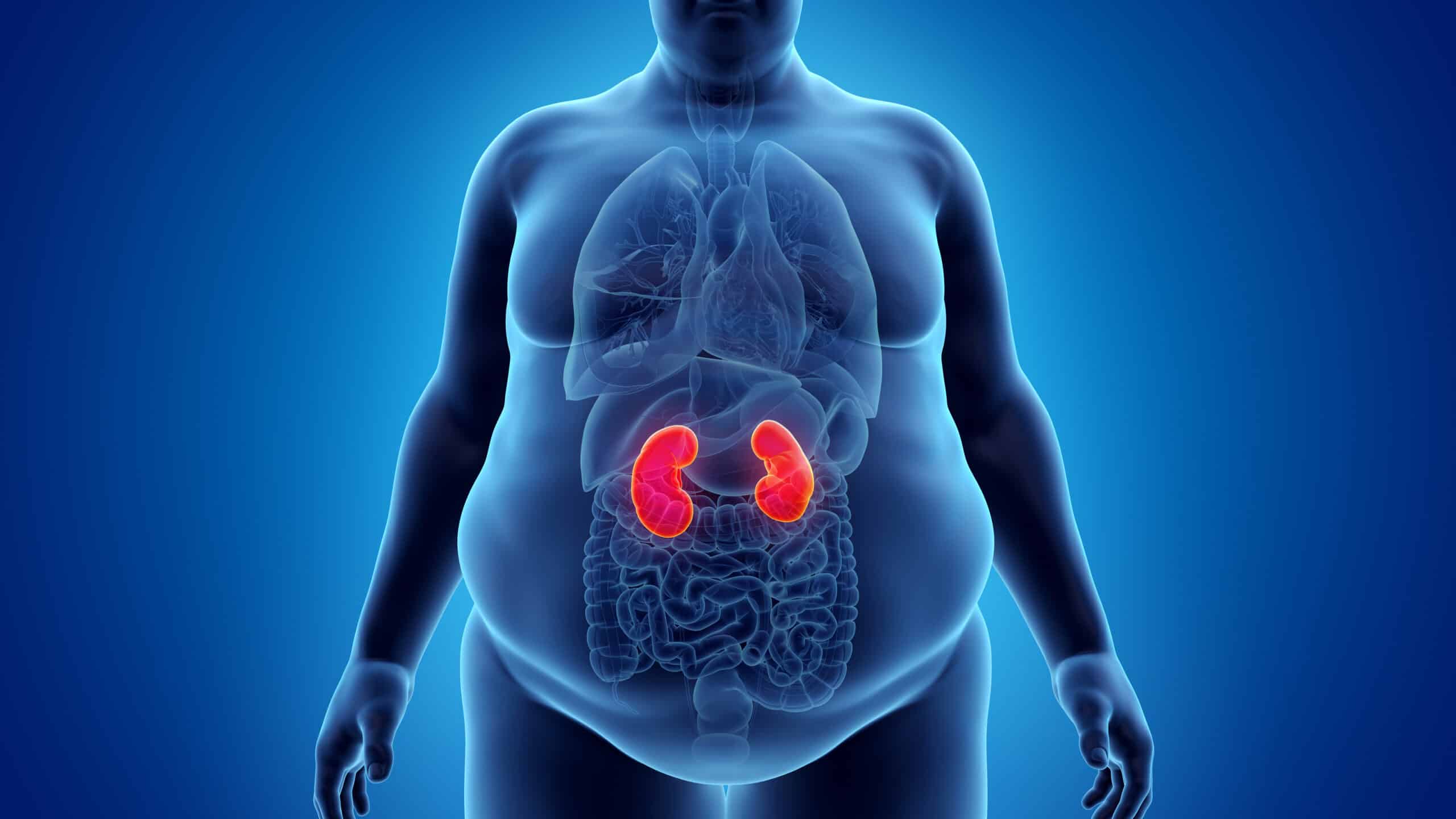 MALADIES RENALES ET OBESITE – SOCIETE INTERNATIONALE DE NEPHROLOGIE